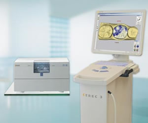 cerec-crowns-1
